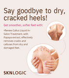 Renew Foot Balm