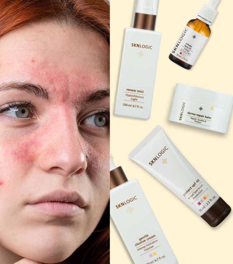 Skin Rescue Essentials Kit Skin Rescue Essentials Kit