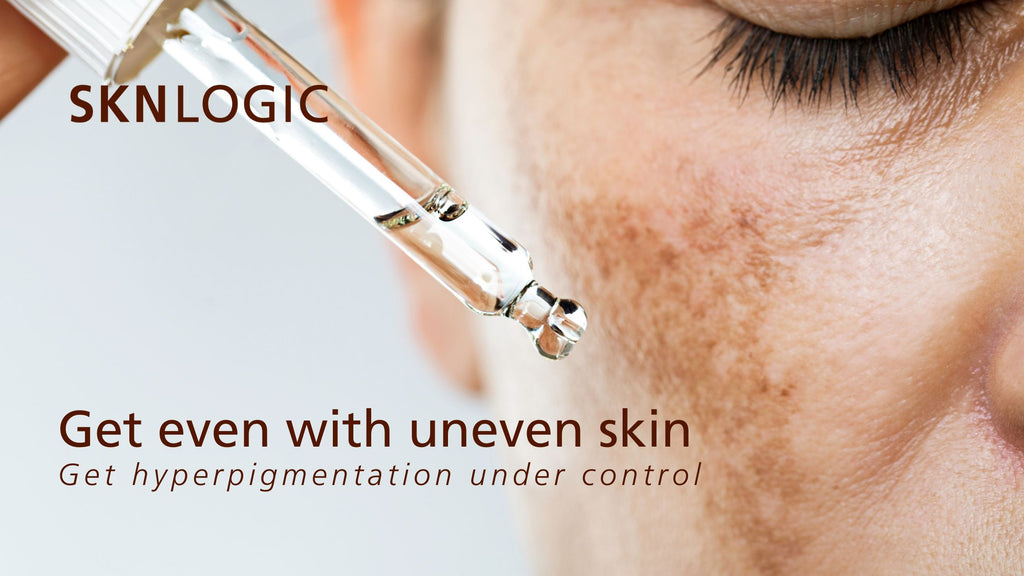 Hyperpigmentation - Get even with uneven skin