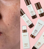 Dark Spot Control Advance Kit