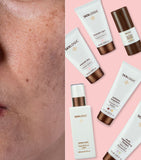 Dark Spot Control Advance Kit