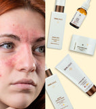 Skin Rescue Essentials Kit